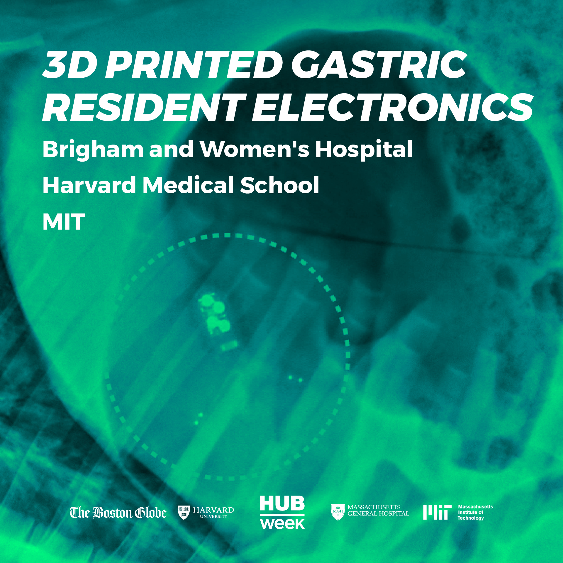 3D-Printed-Gastric-Resident-Electronics-Brigham-Womens-Hospital-Harvard-MIT-1
